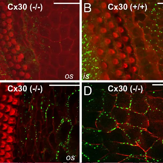 Connexin 30 Mutation Detection Test
